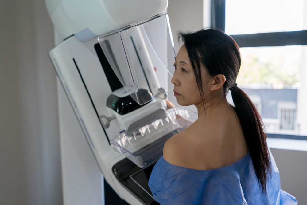 Self-referral mammograms for breast screening